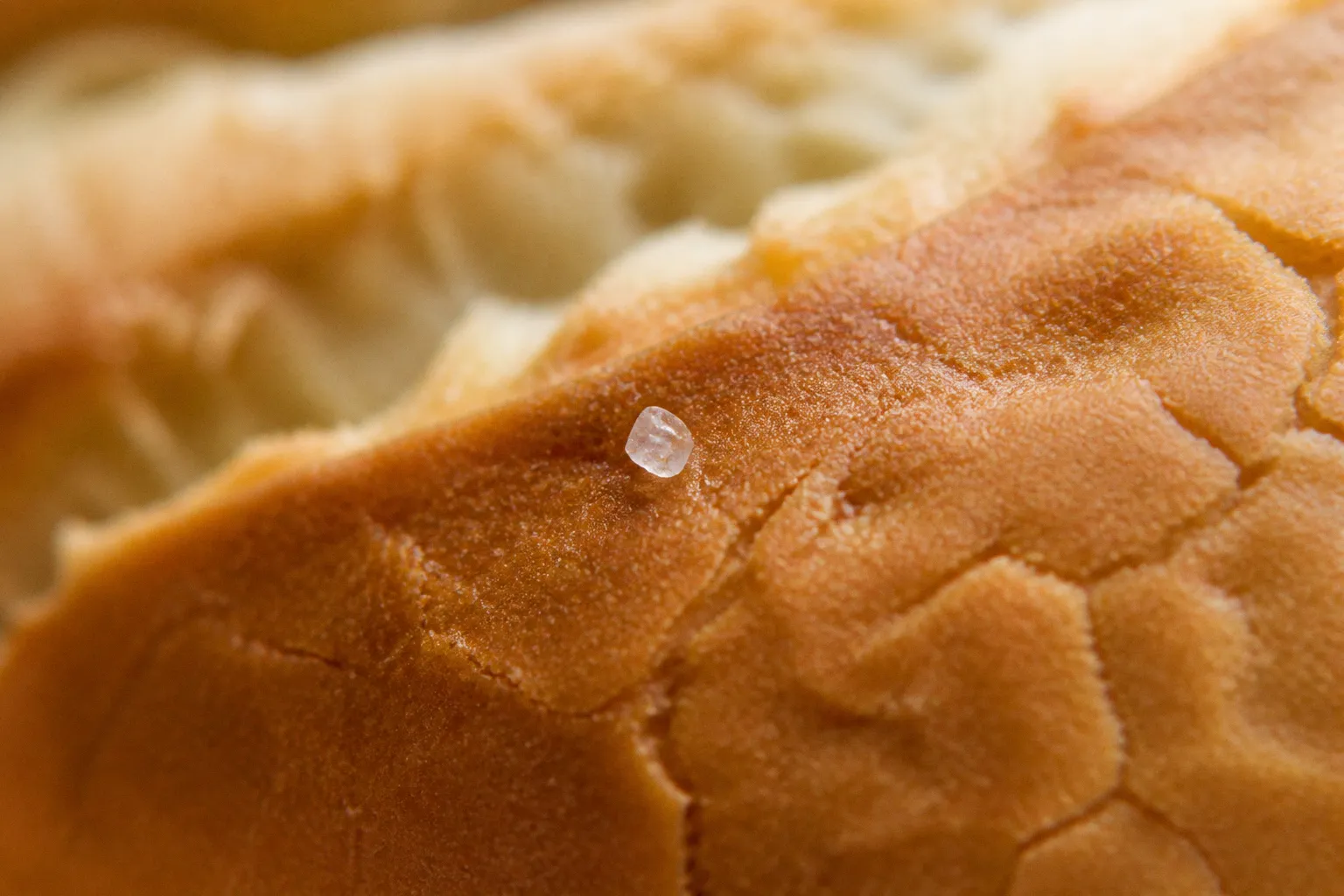 Hipertensión por sodio oculto: el caso de Manuel